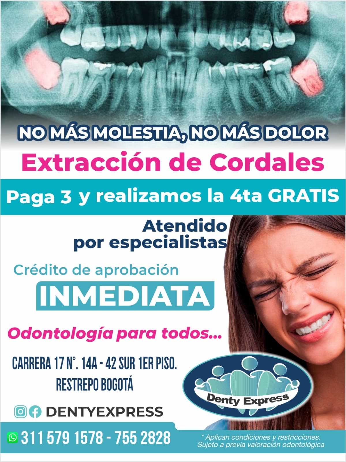 Promoción de extracción de cordales