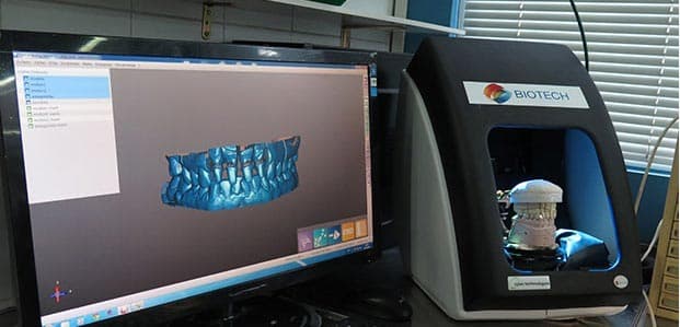 Rehabilitación Oral – Digital